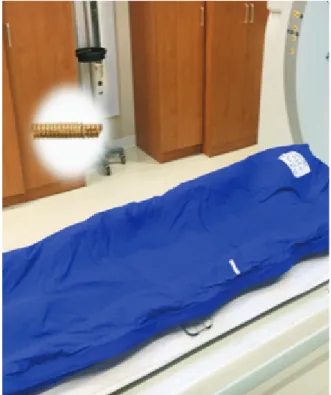 Fig. 2. Immobilization	device,	Arm-rest	 Fig. 3. Immobilization	device,	Vac-lock	and	Gold	fiducial	