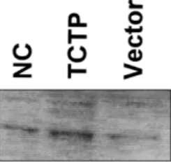 Fig. 4 − Effect of endotoxin on TCTP-induced JNK activation. PC12 cells were treated for 20 min with 40 µg/ml TCTP or pET empty vector protein or left untreated (negative control, NC)