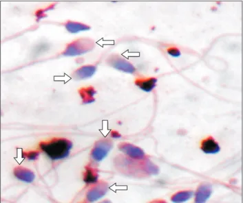 Fig. 8. Specificity test of anti-proprotein convertase subtilisin/kexin type 4 (PCSK4) to PCSK4 using Western blot and dot blot technique.