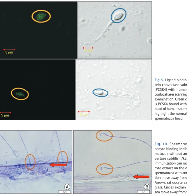 Fig. 9. Ligand binding receptor (propro- (propro-tein convertase subtilisin/kexin type 4  [PCSK4] with human anti-PCSK4) with  confocal laser scanning microscope (CLSM)  examination