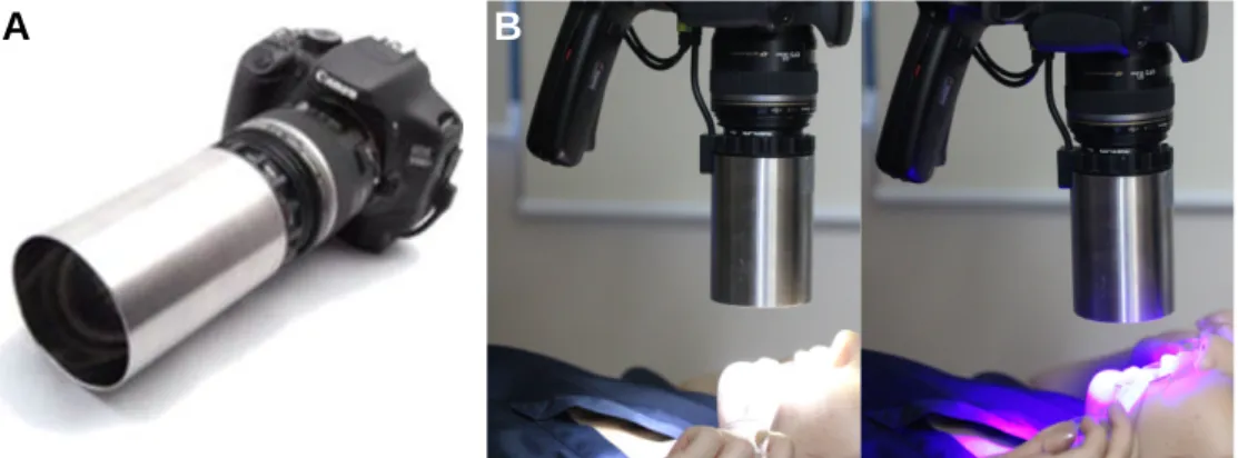 Fig. 1. (A) QLF-D camera. (B) Intraoral and QLF-D images can be continuously obtained by automatically changing the light source.