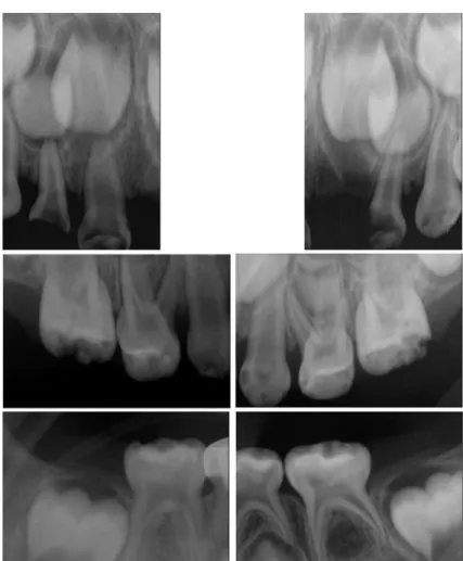 Fig. 2. Extraoral photo after induction of general anesthesia.