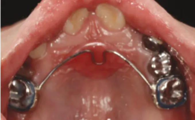 Fig. 4. SpO 2 and  ETCO 2 concentration  during  dental  treatment under general anesthesia.