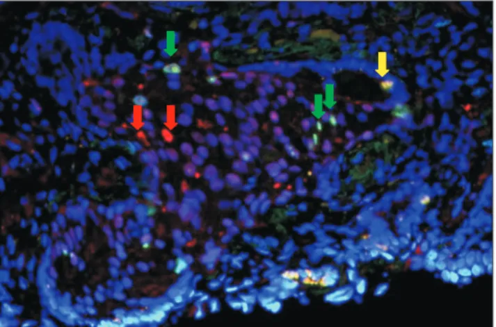 Fig. 6. Double-immunofluorescent staining (×40) showing cells  with positive co-expression for estrogen receptor (ER)-beta and Ki67  stained yellow (yellow arrow) while some proliferating cells not  ex-pressing ER-beta are stained green (green arrows) and 