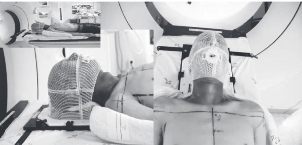 Fig 1.  Patient alignment with immobilization devices for CT simulation