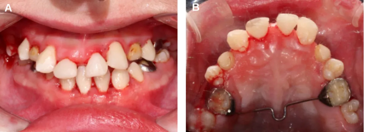 Fig. 3. Post-operative intraoral view.