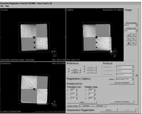 Fig. 4. Macroscopy Setup with laser