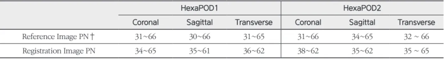 Fig. 7. Pixel per Gray value of CT-Simulation(Reference Image) vs Conebeam Computed Tomography(Registration Image)Table 1