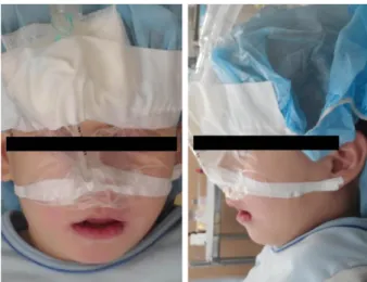 Fig. 1. Extraoral photo after induction of general anesthesia.