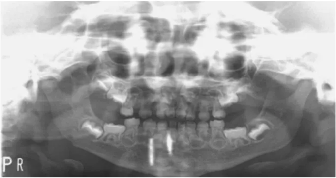Fig. 3. Induction of general anesthesia.