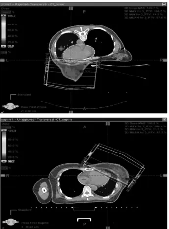 Fig. 2. Q-fix 社의 Prone breast board(Kvue Access 360 RT-