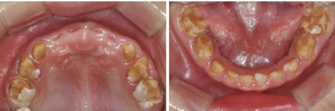 Fig. 2. Panoramic radiograph.