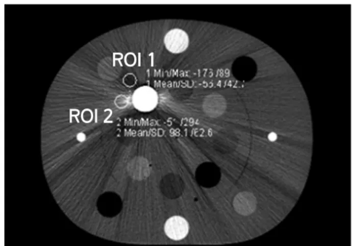 Fig. 3. ROI 1(Dark Streaks), ROI 2(Bright Streaks)