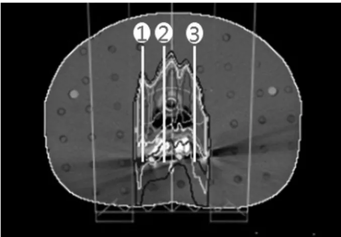 Fig. 9. ROI 2 Mean CT Number(CIRS Phantom)Fig. 8. ROI 1 Mean CT Number(CIRS Phantom)