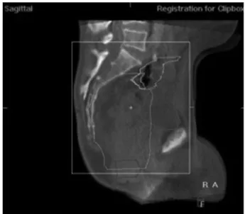 Fig. 2. Set the clipbox for registration(Region Of Interest, ROI)