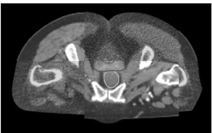 Fig. 7. The image quality of MVCT