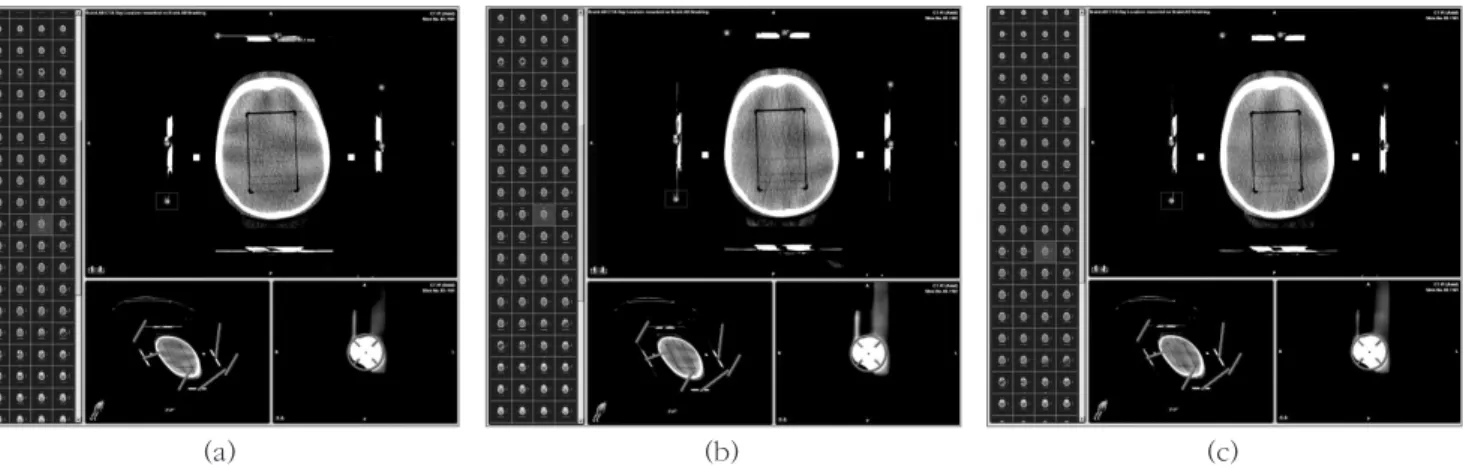 Fig 4. Brain  LAB  localizing  of  phantom  scan  at  1.25  mm  scan  (a),    2.5  mm  to  1.25  mm  reconstruction  (b),    5mm  to