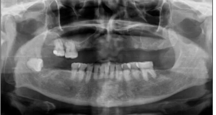 Fig. 1. Initial oral view. Fig. 2. Initial panoramic view.