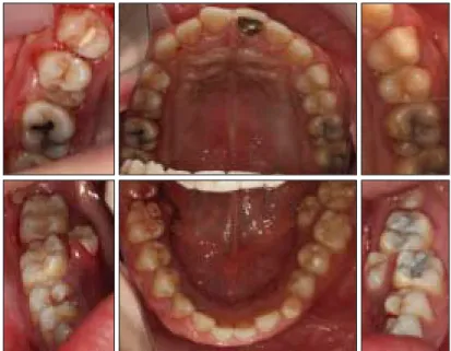 Fig. 1. Intraoral view.