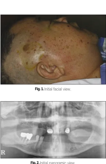 Fig. 1. Initial facial view.