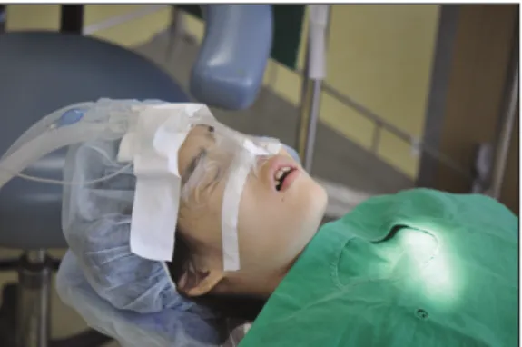Fig. 6. Intraoral view of maxillary arch of post-operation.