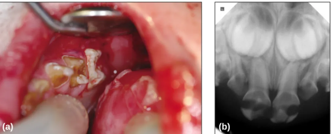 Fig. 1. Digital webbing and scarring were observed.