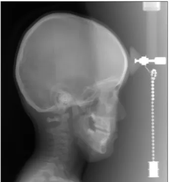 Fig. 7. Panoramic radiograph (2005. 1. 6).