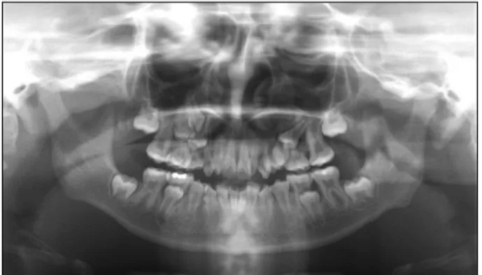 Fig. 1. Panoramic view (11Y 3M).