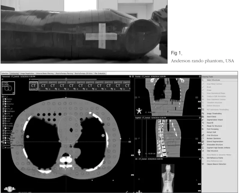 Fig 2. CT contouring images
