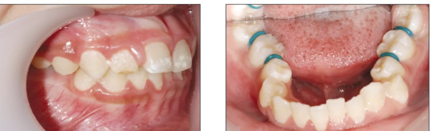 Fig. 2. 치료 시작 전 구내 사진.