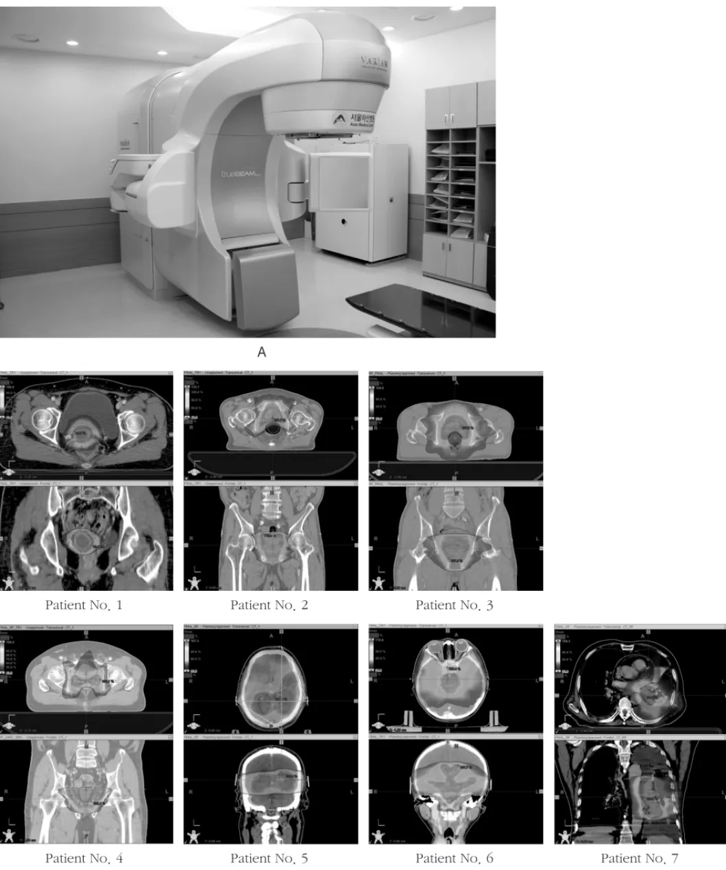 Fig 1. A : TrueBeam TM (Varian Medical Systems, Palo Alto, CA) B : Electronic Portal Imaging Device(EPID)