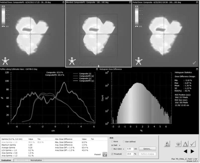 Fig 1. Portal dosimetry evaluation using Gamma Inex(GAI).