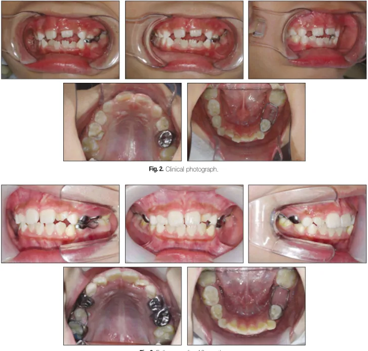 Fig. 4. Follow-up after 14 months.