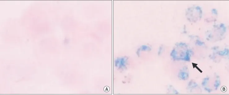 Fig. 1. Prussian blue staining of human mesenchymal stem cells with or without superparamagnetic iron oxide nanoparticles labeling