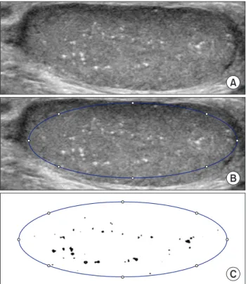 Fig. 1. Measuring method of calcified area. First choose maximum  cross-sectional area in ultrasound (A), and define testis area (B) and  calcified area by distinct color (C)