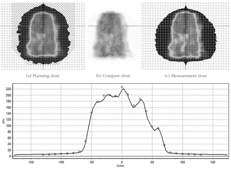 Fig 2. The first plan measurement. The A is the treatment planning dose. The c is measurement dose by MapCheck2