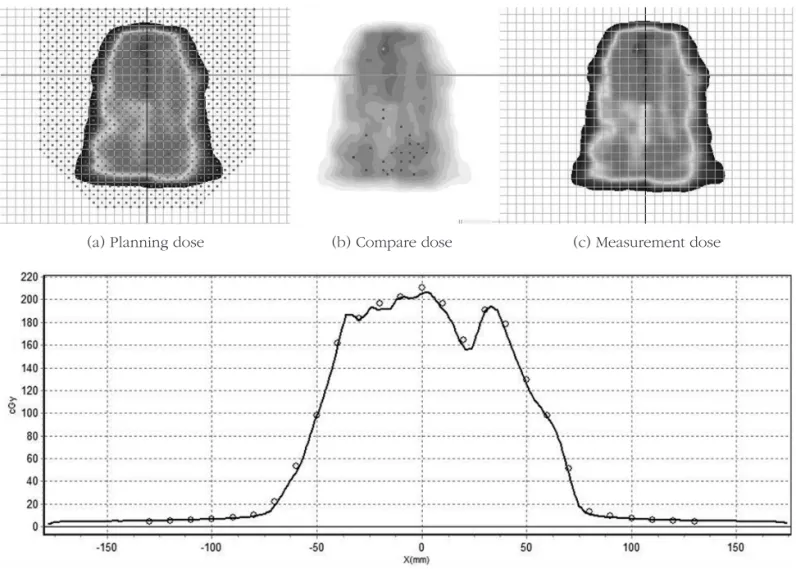 Fig 3. The  re-optimization  plan  measurement.  The  A  is  the  treatment  planning  dose