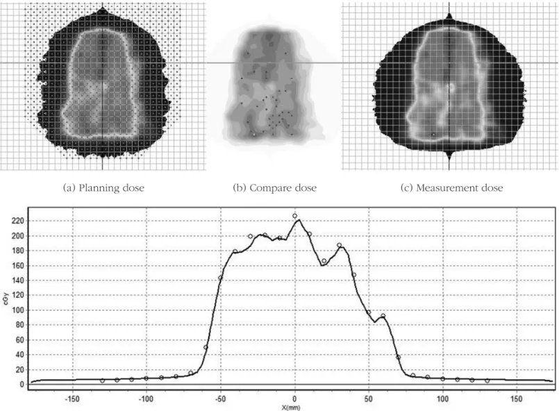 Fig 4. Compare first plan dose and re-optimization plan measurement.