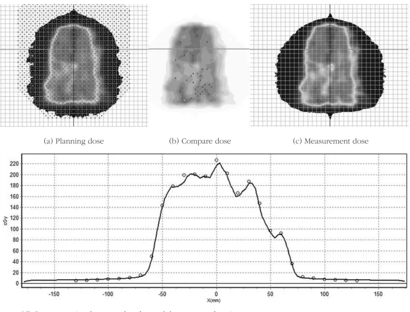 Fig 5. Compare first plan dose in Monte Carlo algorism and re-optimization plan measurement by pencil beam algorism