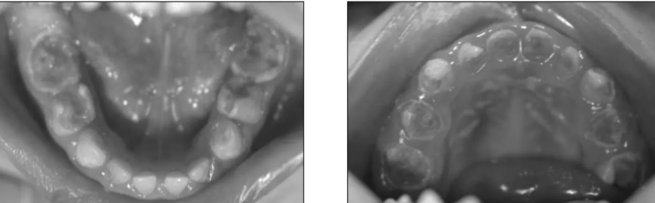 Fig. 1.  Preoperative intaoral views (case 1).