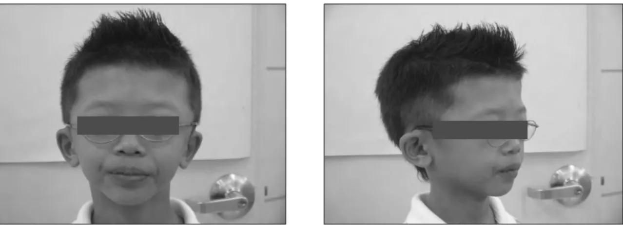 Fig. 3.  Extraoral views (case 2).