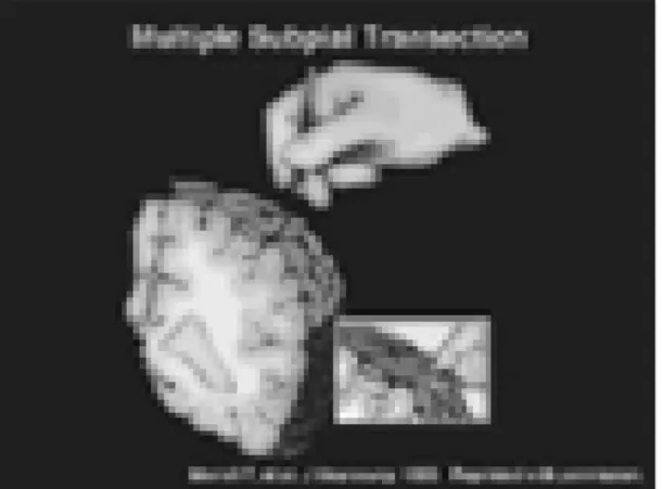 Fig. 3.  Disconnection Procedures.