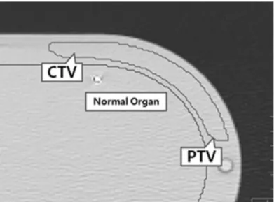 Fig 2. The  phantom  axial  image,  which  displays  the hypothetical target structures and the normal organ