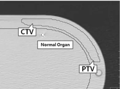 Fig 2. The  phantom  axial  image,  which  displays  the hypothetical target structures and the normal organ