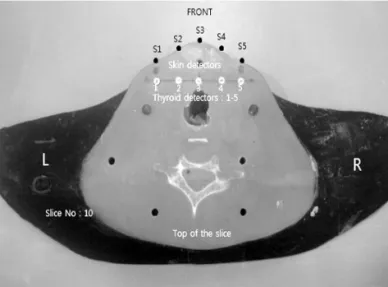 Fig 1. Phantom irradiation setup. Fig 2. Placement of the PLDs in the phantom’s thyroid.
