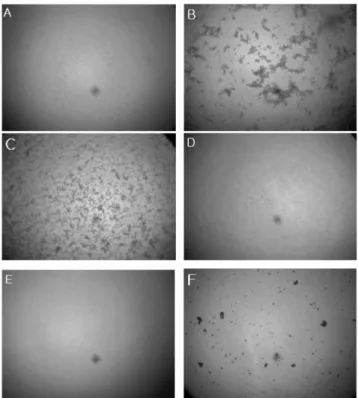 Fig. 1 − Effect of Mume Fructus extract (ME) on the ADP-induced Rat platelets aggregation