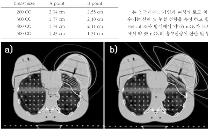 Table 1. The  distance  between  A-point  and  B-point  by breast size