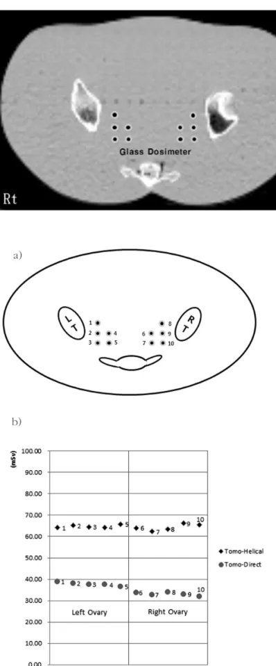 Fig 6. CT  scan  of  slice  #32.  Glass  dosimeter points of measurement are shown.