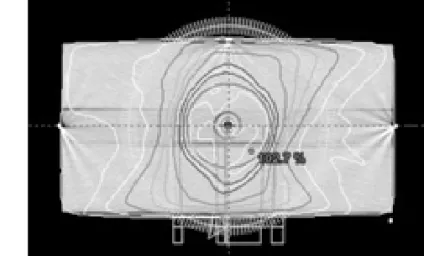 Fig 2. Water equivalent solid phantom