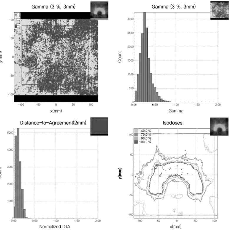 Fig 6. Comparison of dose distribution of Non-Gated and Gated RapidArc